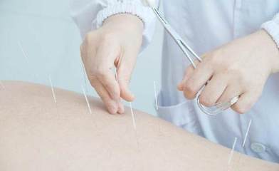 针灸适合的人群有哪些