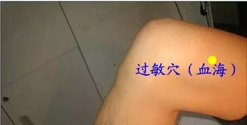 王文远丨平衡针灸创始人 38个穴位图与文