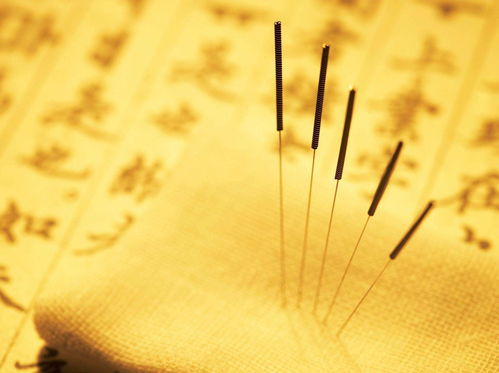 针灸历经千年而不衰,这其中的奥秘你了解多少
