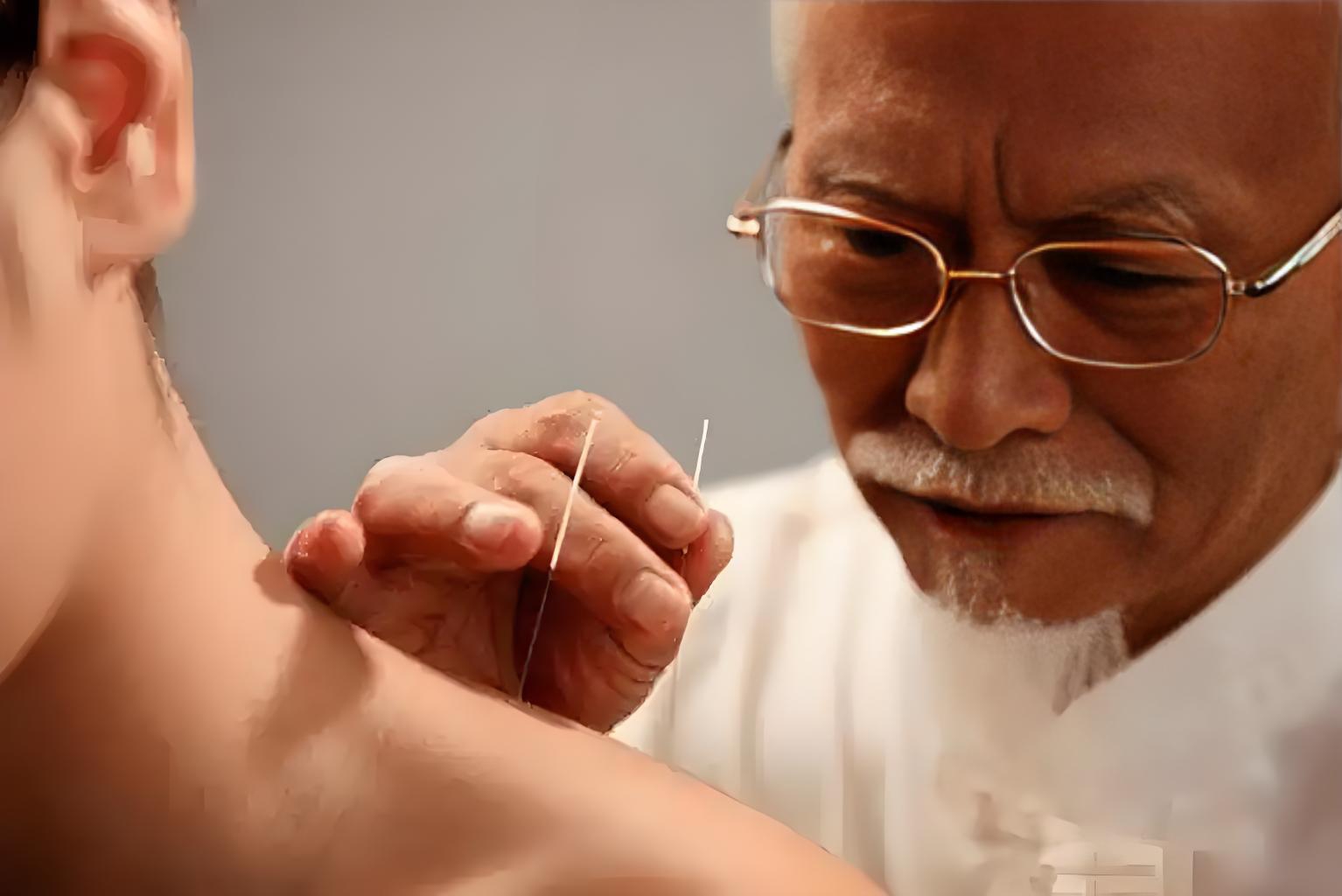 中国针灸的十大流派