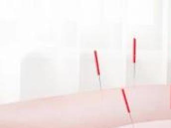 图 针灸特技培训班,长洋中医循环开课 北京企业管理 mba