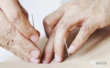 都是“断针”惹的祸!八十岁老太私人诊所针灸,结果“针”上手术台_社会_网