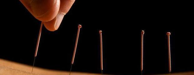 令人困惑的针灸