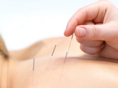 针灸减肥原理 针灸减肥如何才更健康安全