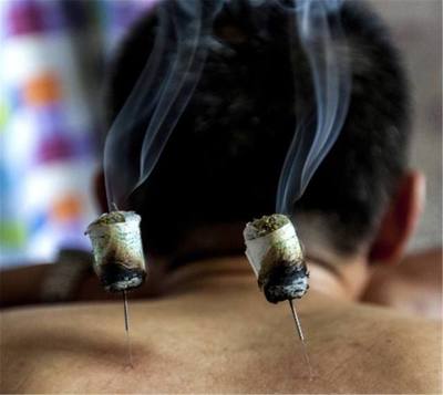 艾灸很简单,好好看一遍,你就能学会