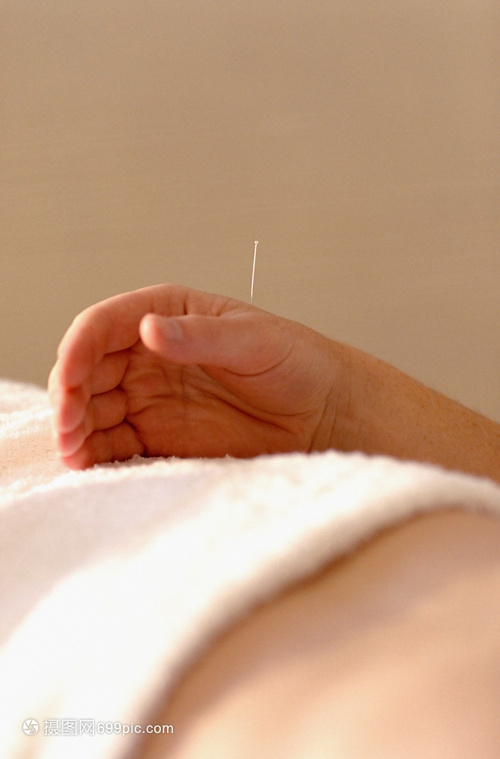 针灸