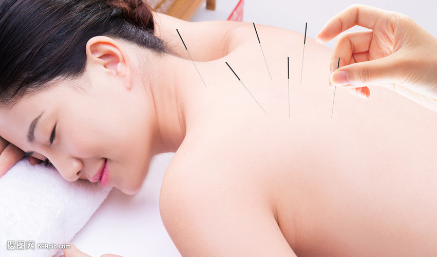 针灸养生
