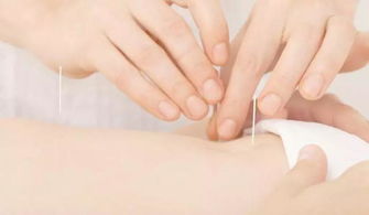 中医针灸的入门必学知识 针刺法及其注意事项