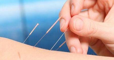 针灸减肥安全吗?三大误区可能人人都在犯