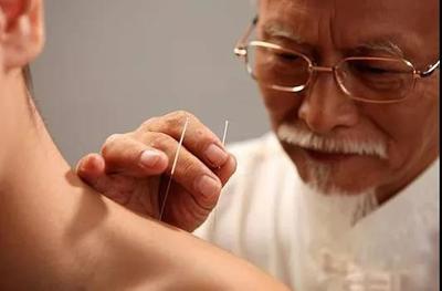 降龙针疗法,针灸从业者的福音