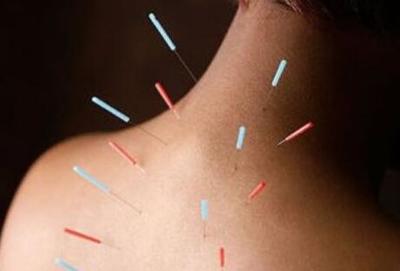 中医针灸专家张勤治疗颈椎病