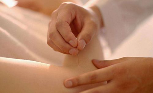 针灸真的能美容吗 分析针灸美容的原理