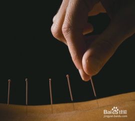针灸可能不会增加试管婴儿成功的机会