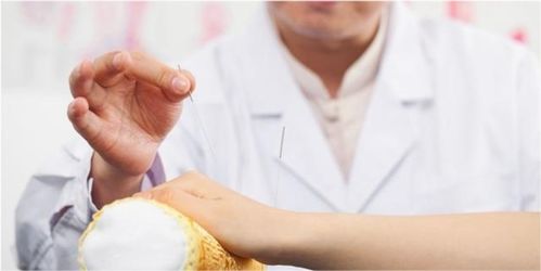 针灸治疗风湿性关节炎有效果吗