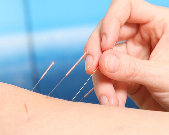 中医针灸减肥的方式有哪些_健康_网