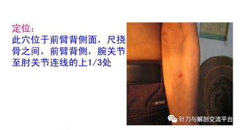 平衡针灸初学者教案及常用穴位图