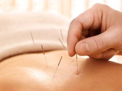 书籍推荐:针灸你需要看的几本书!