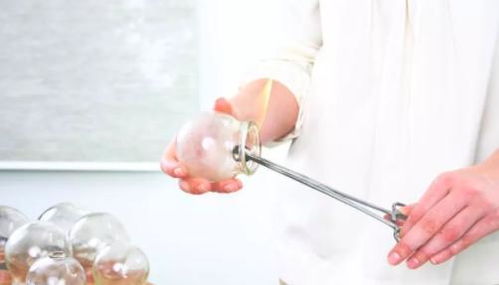 拔火罐时,皮肤留下的 黑紫色印记 ,真的是在排出体内毒素吗