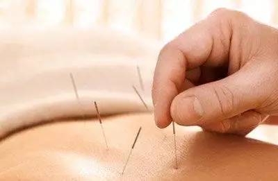 月经不调你治疗的效果不佳?那是因为你没选对方法!