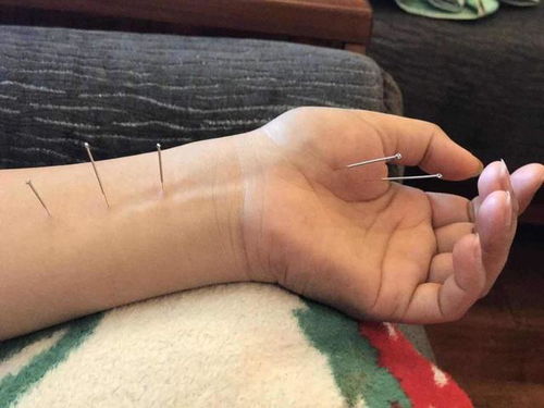 针灸大师赵缉庵 晚清医学守护者,如何以一己之力振兴针灸医学