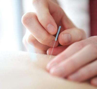 最新研究发现:针灸可以促进骨折愈合