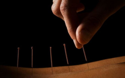 针灸对腰椎间盘突出症患者有什么用?