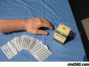 针灸：古老而神奇的东方医疗技艺