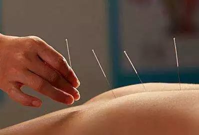 广东医保新举措 针灸推拿纳入报销，助力中医药发展