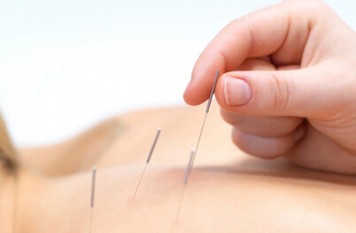 针灸的作用及针灸美容的好处
