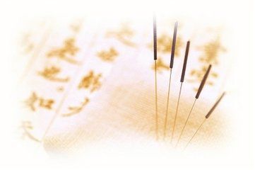 针灸 自然的疗愈之道