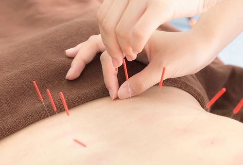 针灸 根植于自然的疗愈智慧