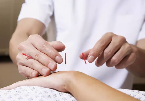 警惕 睡眠障碍可能是焦虑与抑郁的预警信号，针灸或可成为干预新路径