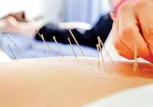 针灸刺法全过程图解 终生受益的中医精粹